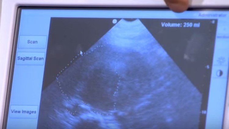Ultrasound on woman's bladder.