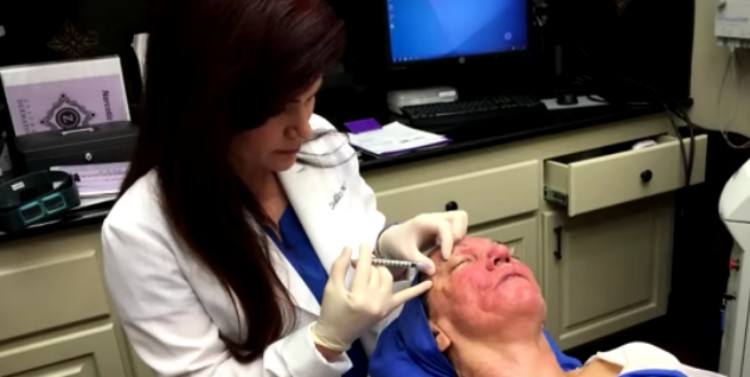 Dermatologist injecting Pamela with fillers