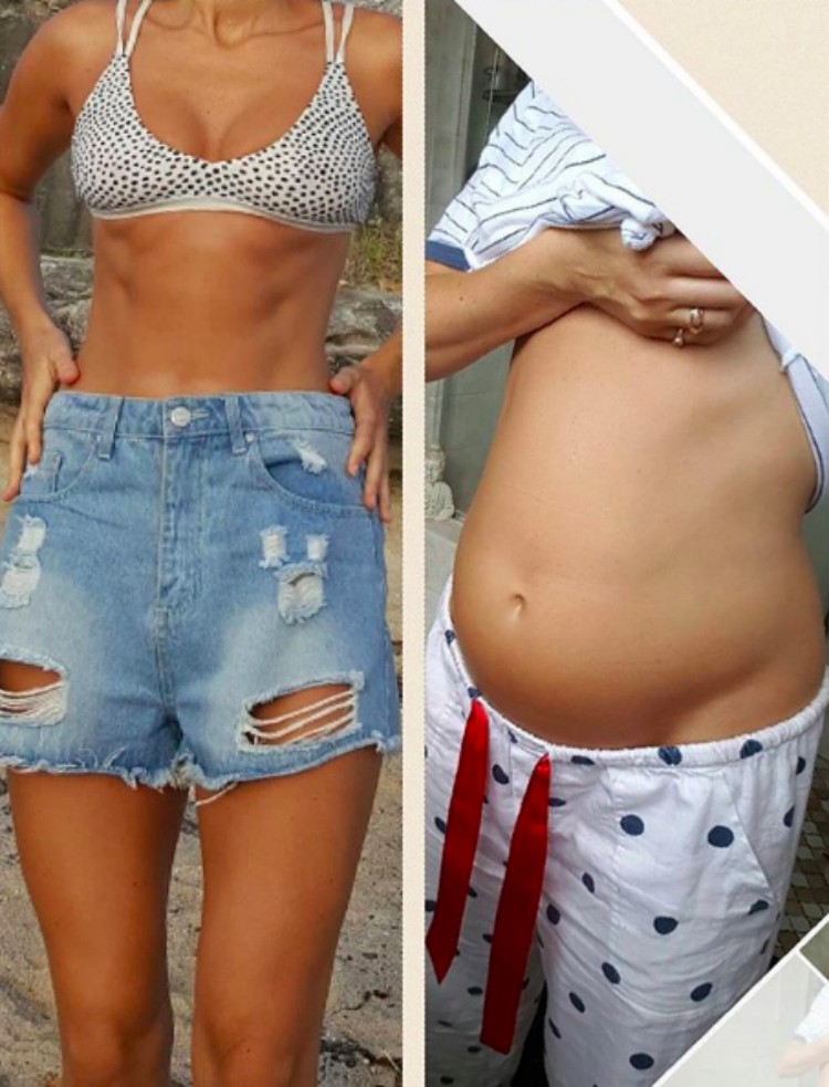 Back to back image of model Alyce Crawford showing bloated stomach