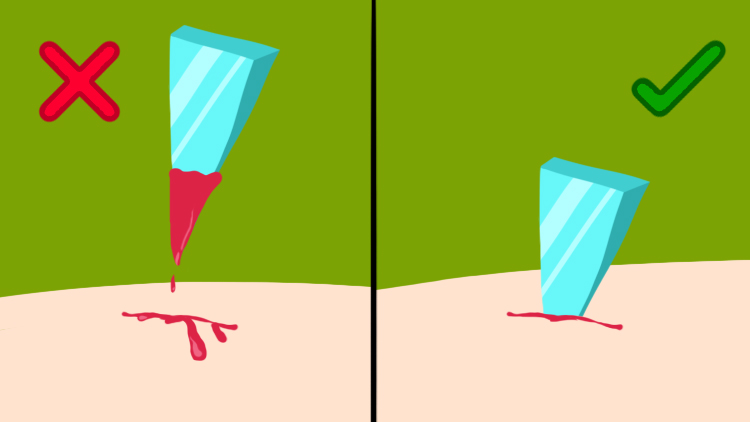 Illustration of glass stuck in skin bleeding