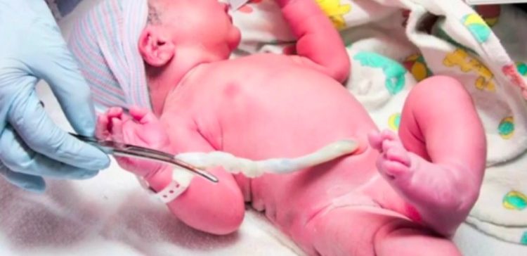 baby with umbilical cord