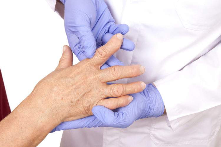 Image of senior woman with Rheumatoid arthritis visit a doctor Isolated on white