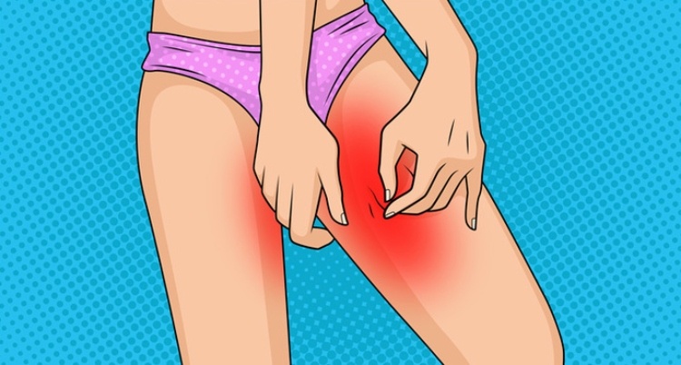How to Prevent Chafing Between Your Thighs (Or Treat It, If It's