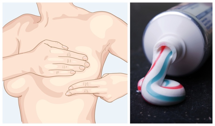 Why Some Women are Putting Toothpaste On Their Breasts