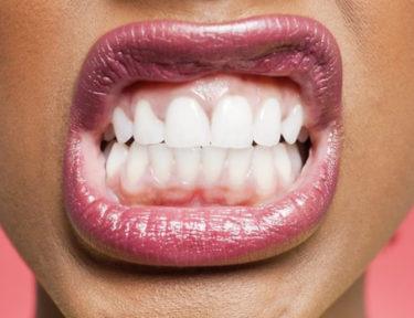 Image of woman showing teeth.
