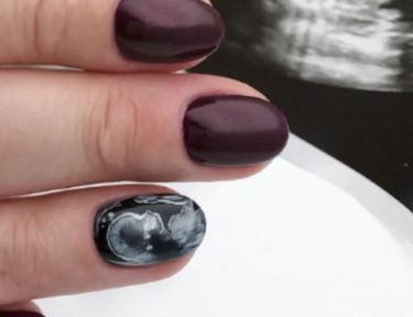 woman models ultrasound nails