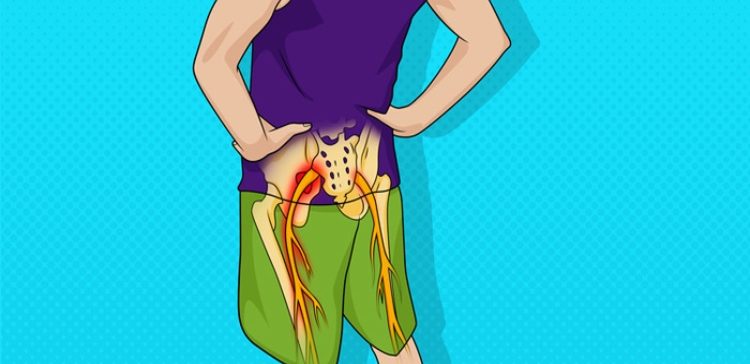 Graphic image displaying back pain