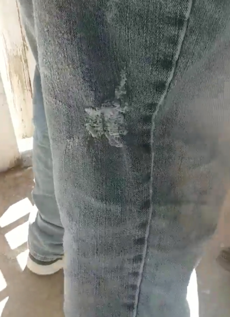 Image of "emerging hole" in pants
