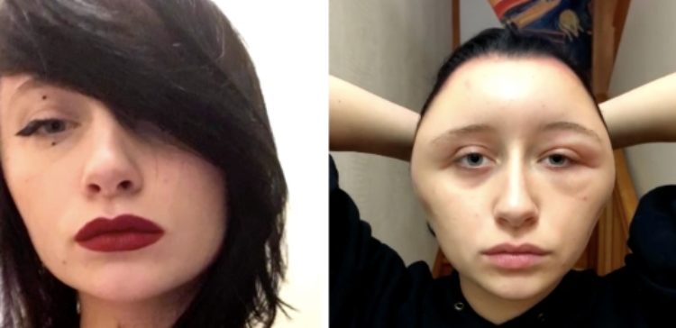 side-by-side hair dye allergy