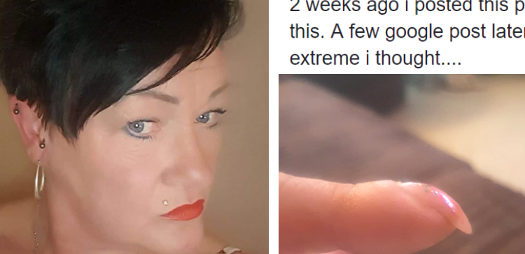 Split image of woman and a curved finger nail