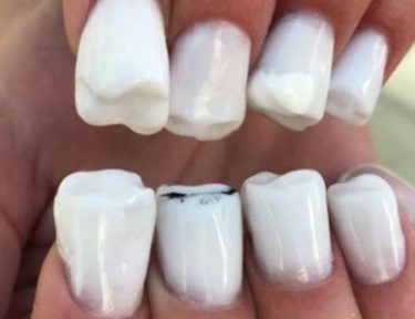 Image of teeth nails