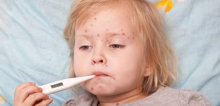 Image of sick boy with measles and thermometer