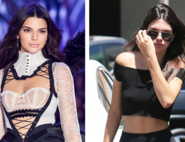 Nipple Injections Inspired by Kendall Jenner Are on the Rise
